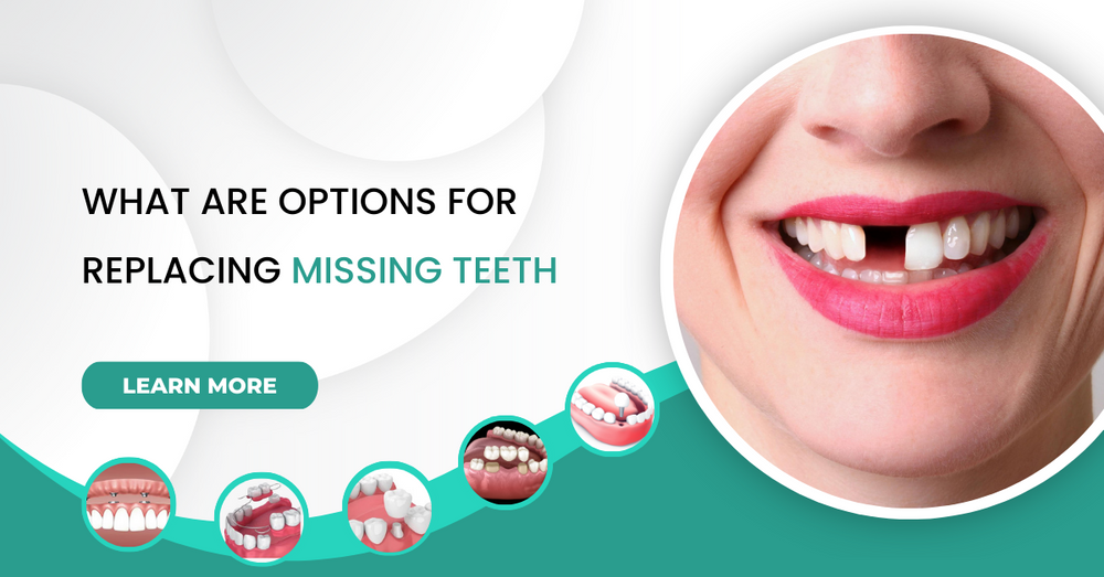 What are Options for Replacing Missing Teeth