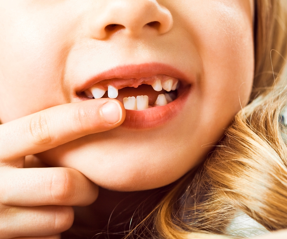 How Can I Identify Signs of Dental Problems in My Child? | TheAmberPost